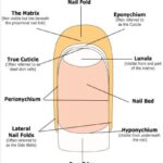 Diagram of Nail Anatomy showing Eponychium, Cuticle, Nail Plate, and Hyponychium